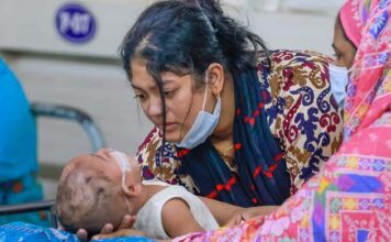 হাম ও উপসর্গে শিশুমৃত্যু সাড়ে ৫শ ছাড়ালো